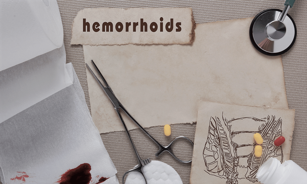 home remedy for hemorrhoids